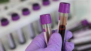 Kan grubunu bilen herkesi ilgilendiriyor - Resim: 2